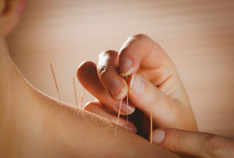 Find Balance and Wellness with Our Expert Acupuncture Services