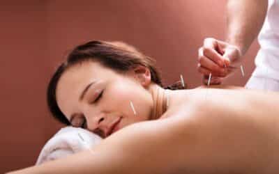 Dos And Don’ts After an Acupuncture Treatment