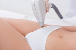 cary laser hair removal